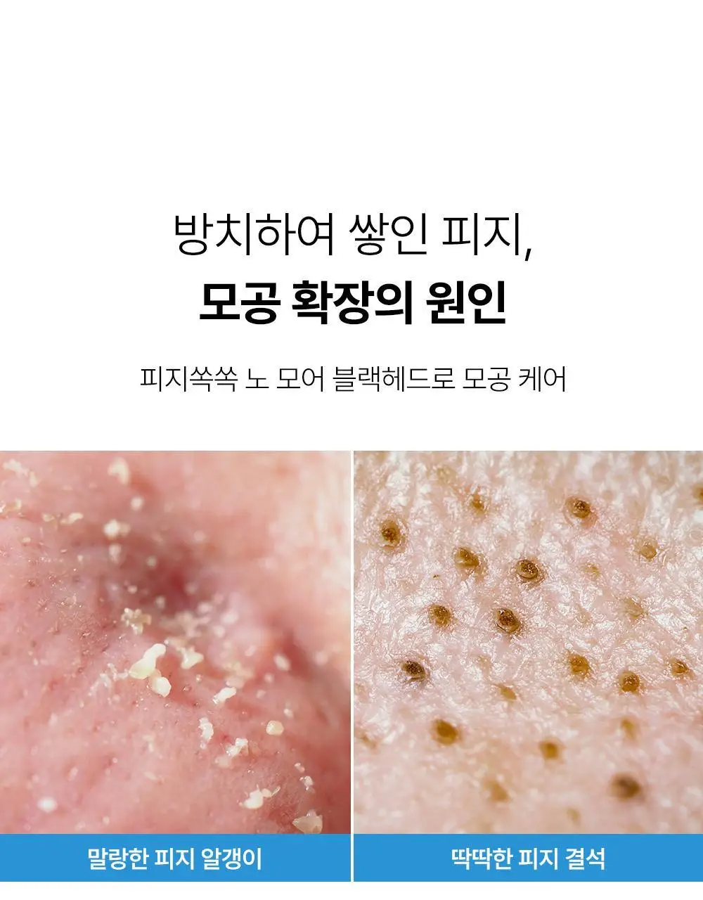 [올영단독] 원데이즈유 피지쏙쏙 노 모어 블랙헤드 100ml 기획 (+코팩 패드 10매 증정) 상세페이지 10
